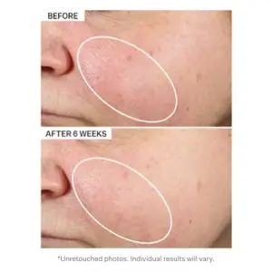 Strivectin Óleo Nutritivo Multi-Action 30ml
