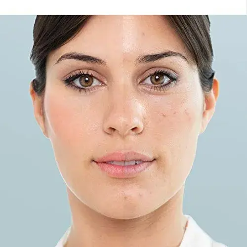 InnovaGoods Sauna Facial Elétrico Hidratação Limpeza Rosa 90ml