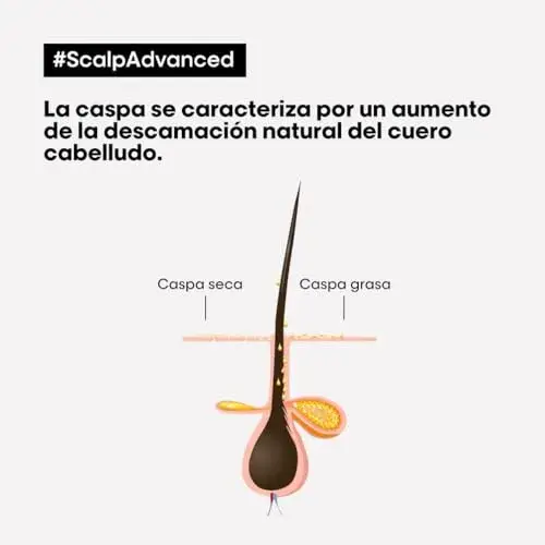 L’Oreal Serie Expert Shampoo Anticaspa 500ml