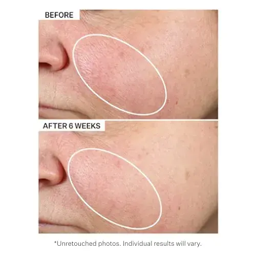 Strivectin Óleo Nutritivo Multi-Action 30ml